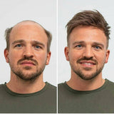 Herenpruik<br> Anti-Calvitia - Perruque-Club