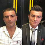 Herenpruik<br> Anti-Calvitia - Perruque-Club